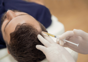 London man receiving exosome hair therapy for hair regrowth and scalp rejuvenation in 2025